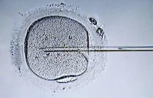 三代试管婴儿虽然备受欢迎，但是也有很多缺点